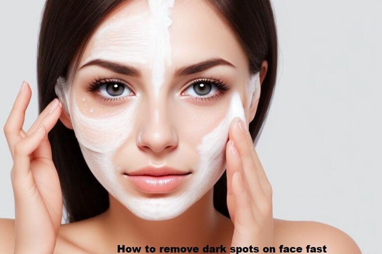 How to remove dark spots on face fast