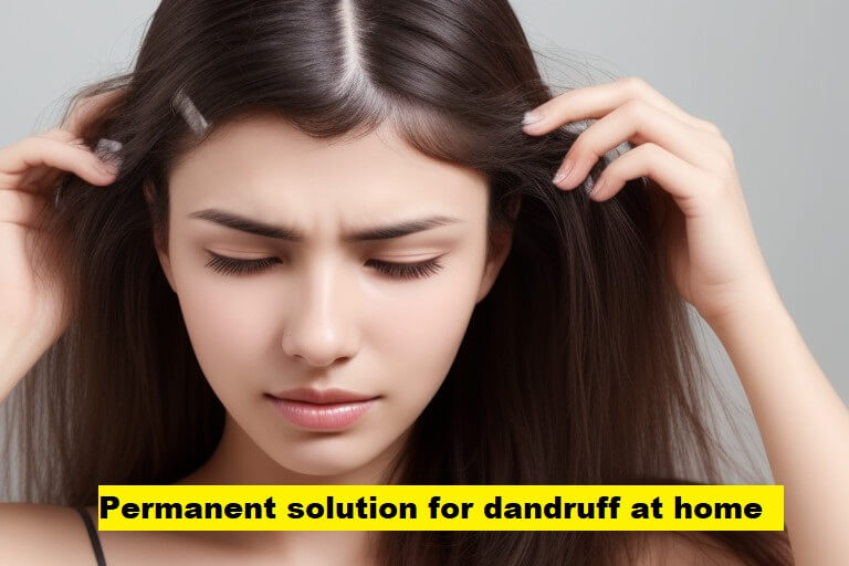 Permanent solution for dandruff at home