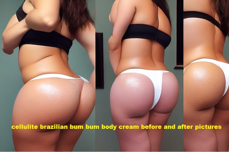 cellulite brazilian bum bum body cream before and after pictures