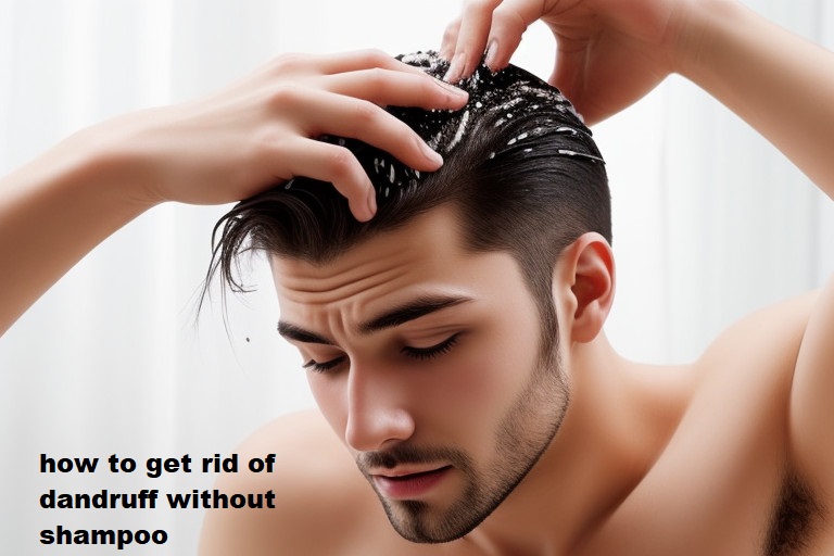 how to get rid of dandruff without shampoo